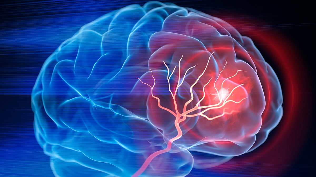 Blow to the brain