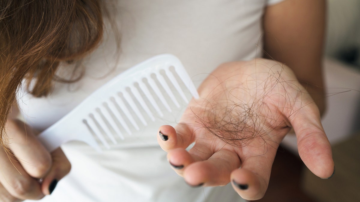 Woman losing her hair in her hair hand in her hand